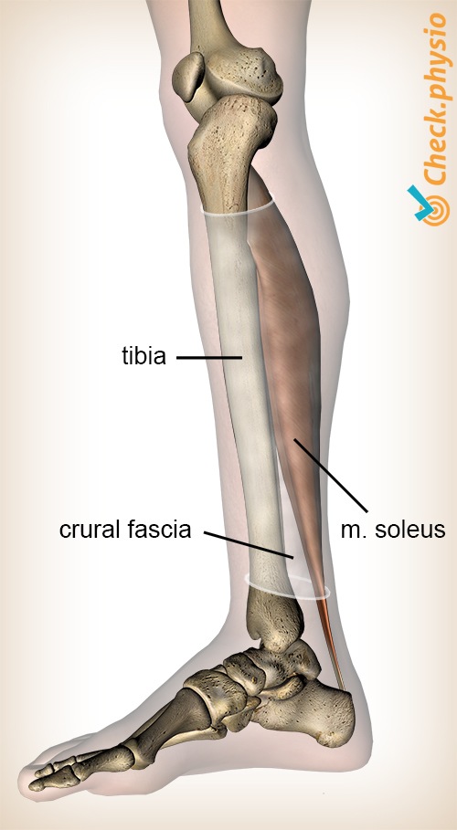 Medial tibial stress syndrome | Physio Check