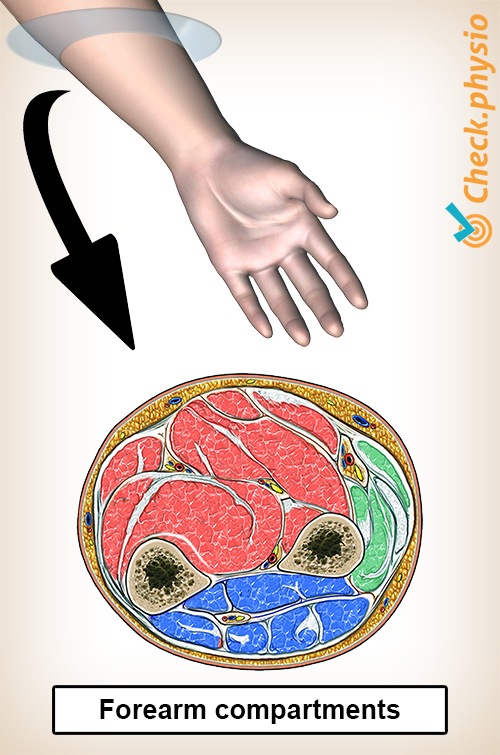 https://www.physiocheck.ca/images/artikelen/175/forearm-lower-arm-compartments.jpg