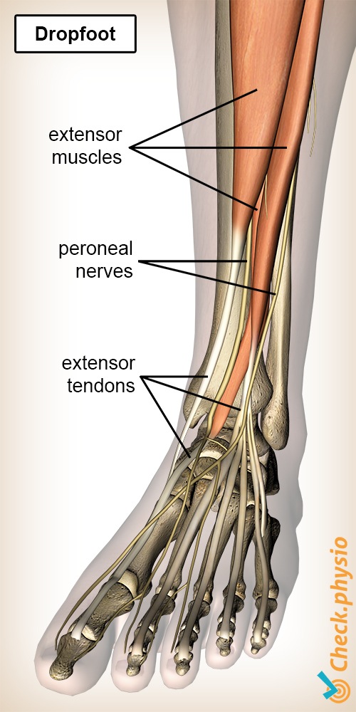 tibialis anterior muscle pain