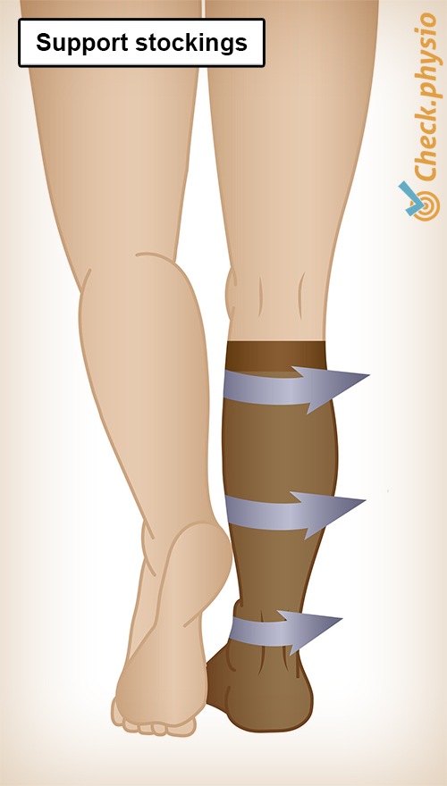 Leg thrombosis | Physio Check