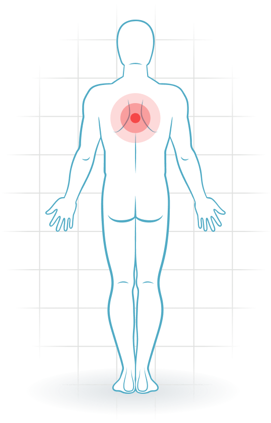 pijnlocatie Dysfunction of the rib joints on the back